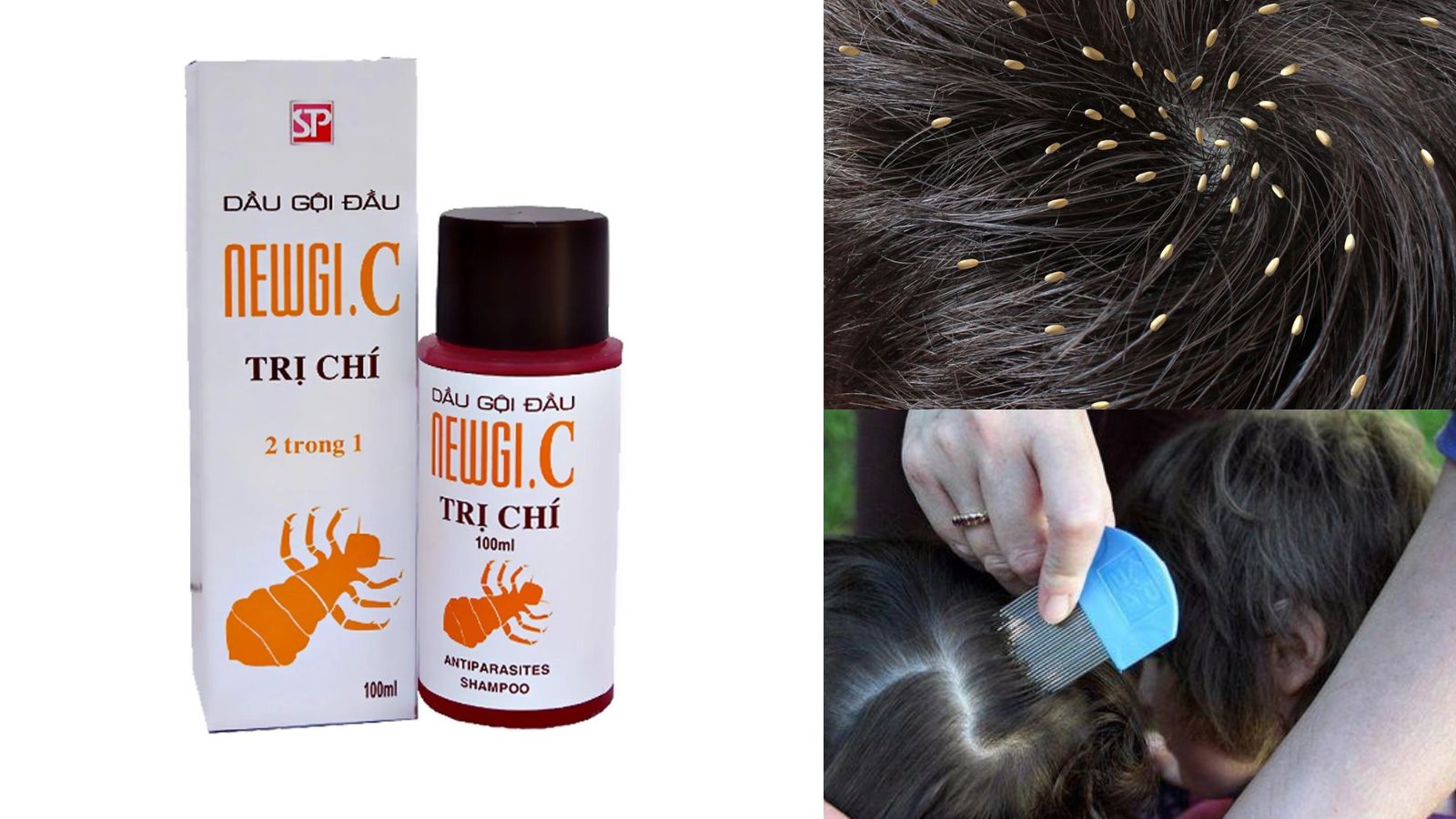 Dầu gội chí Newgi.C loại bỏ sạch chí cắt đứt những cơn ngứa ngáy khó chịu