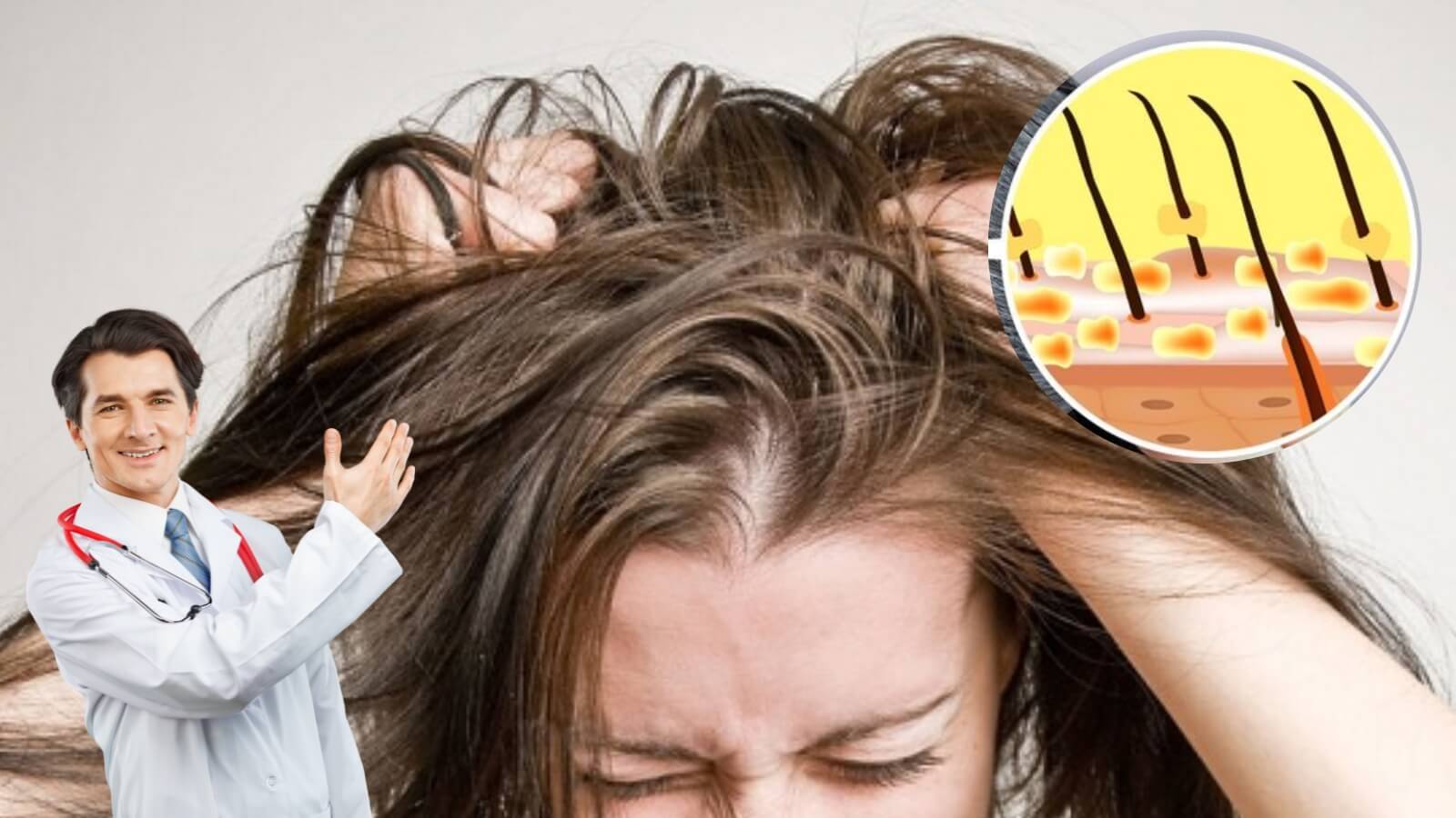 Dầu gội trị gàu gói của Jasunny có tác dụng ngăn chặn nguyên nhân tận gốc.