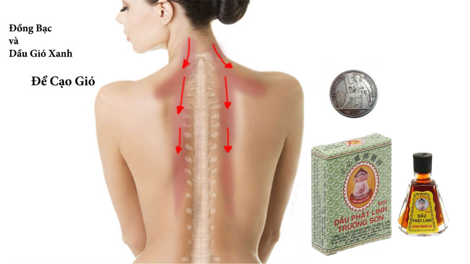 Cạo gió, đánh cảm là một hình thức chữa bệnh, thường là chữa cảm được dùng phổ biến trong dân gian