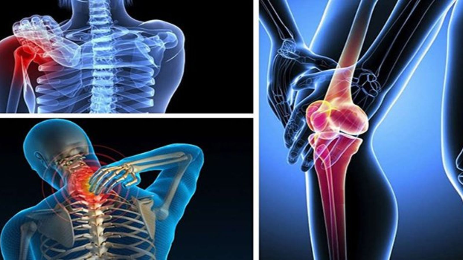 Viên uống hỗ trợ giảm đau xương khớp hiệu quả