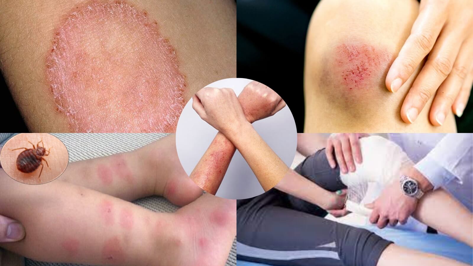 Tổn thương da có thể do nhiều nguyên nhân