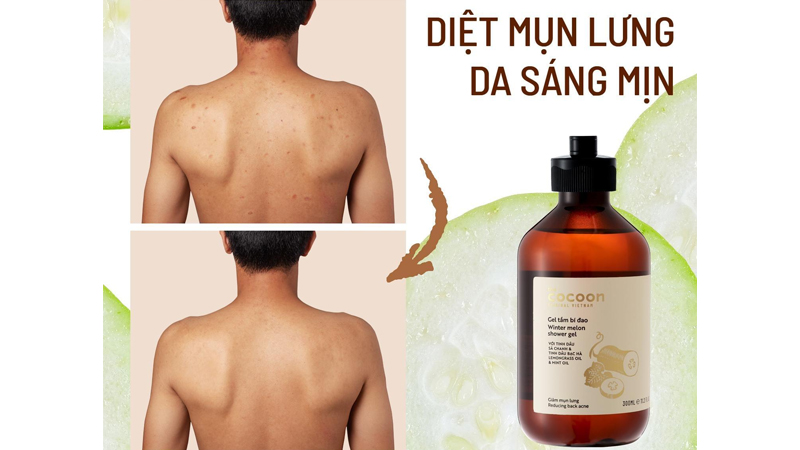 Gel tắm bí đao trị mụn lưng Cocoon mang lại hiệu quả nhanh chóng