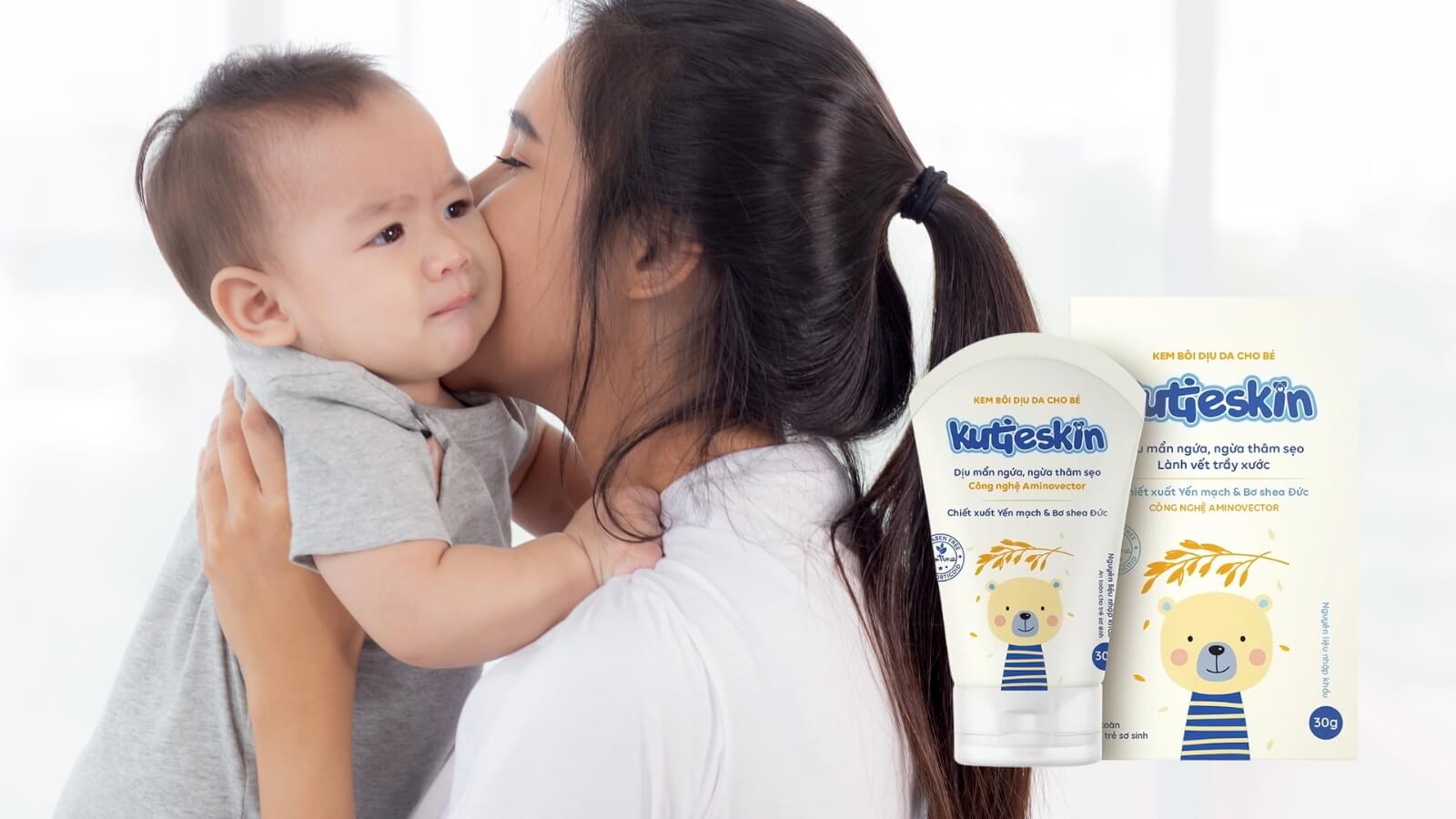 Kem bôi dịu da Kutieskin - Giải pháp hiệu quả cho làn da của bé