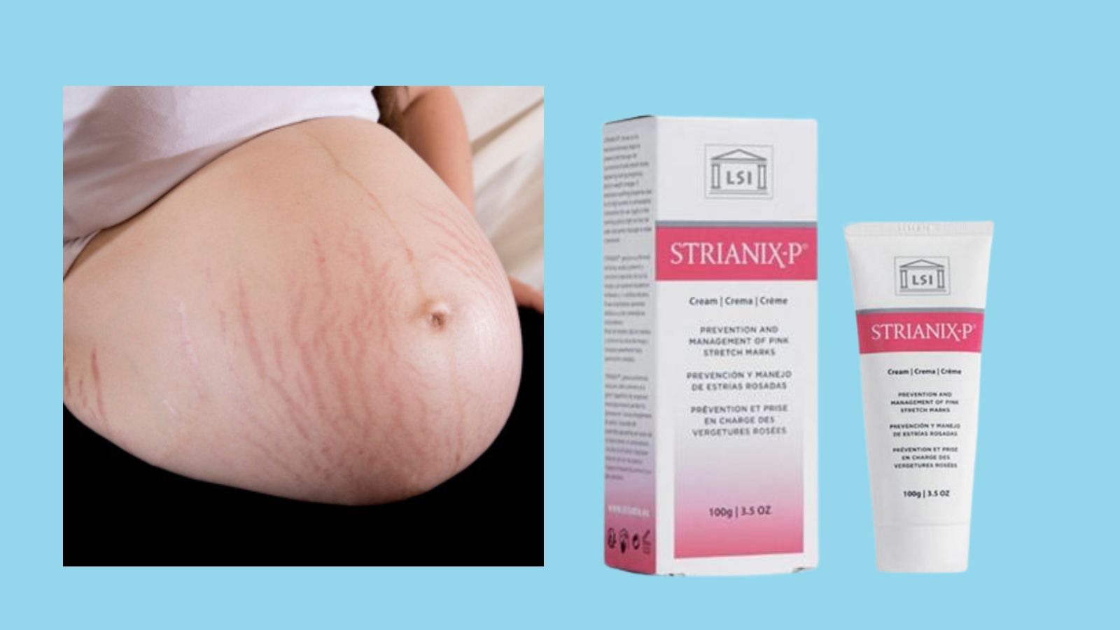Kem trị rạn đỏ Strianix P