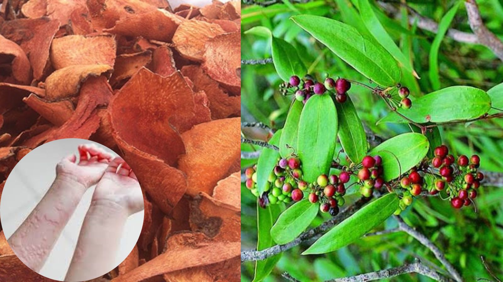 Thổ phục linh hỗ trợ điều trị mẩn ngứa, dị ứng