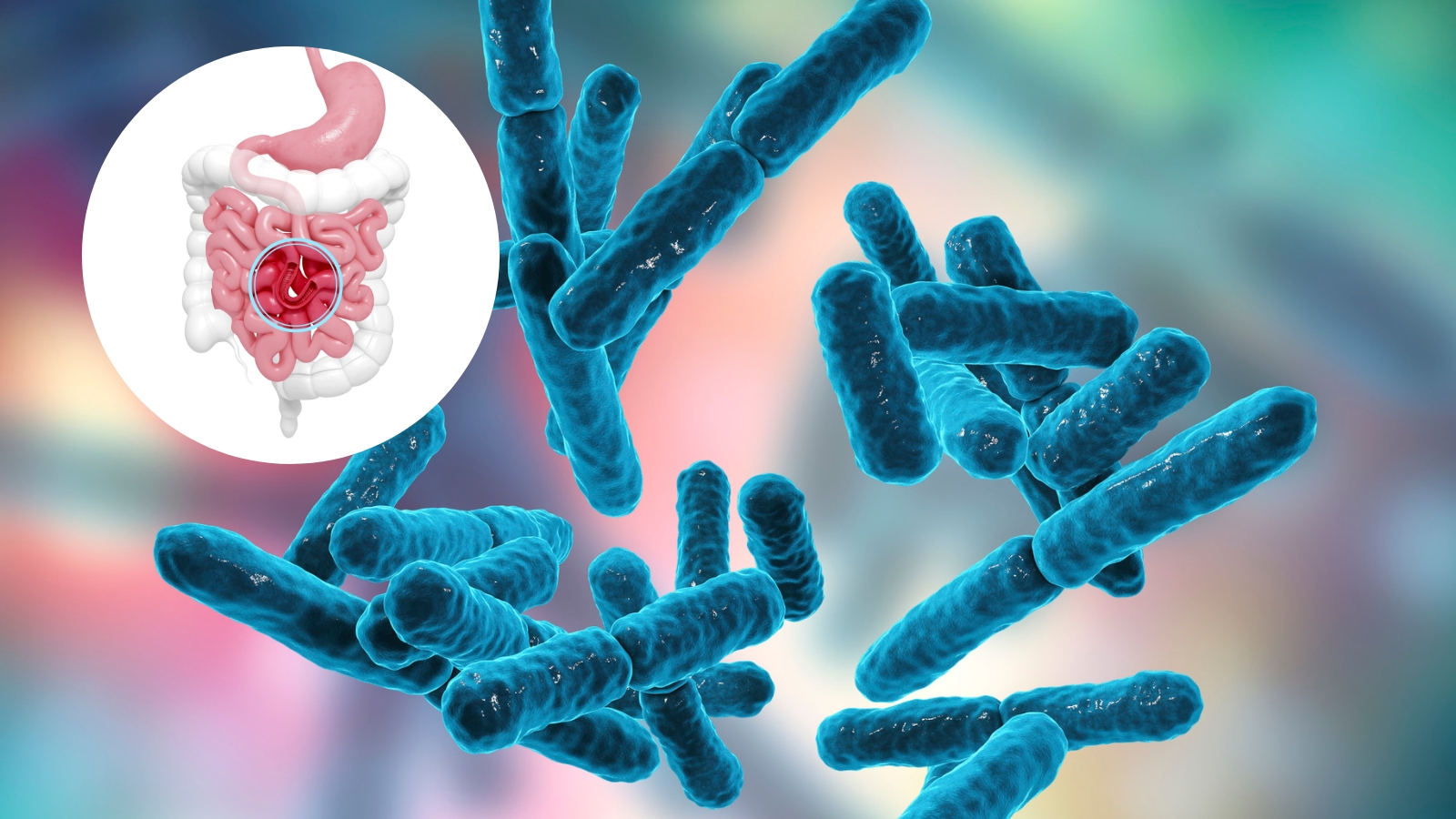 Lactobacillus là một trong hai chủng vi khuẩn có lợi cho đường tiêu hoá