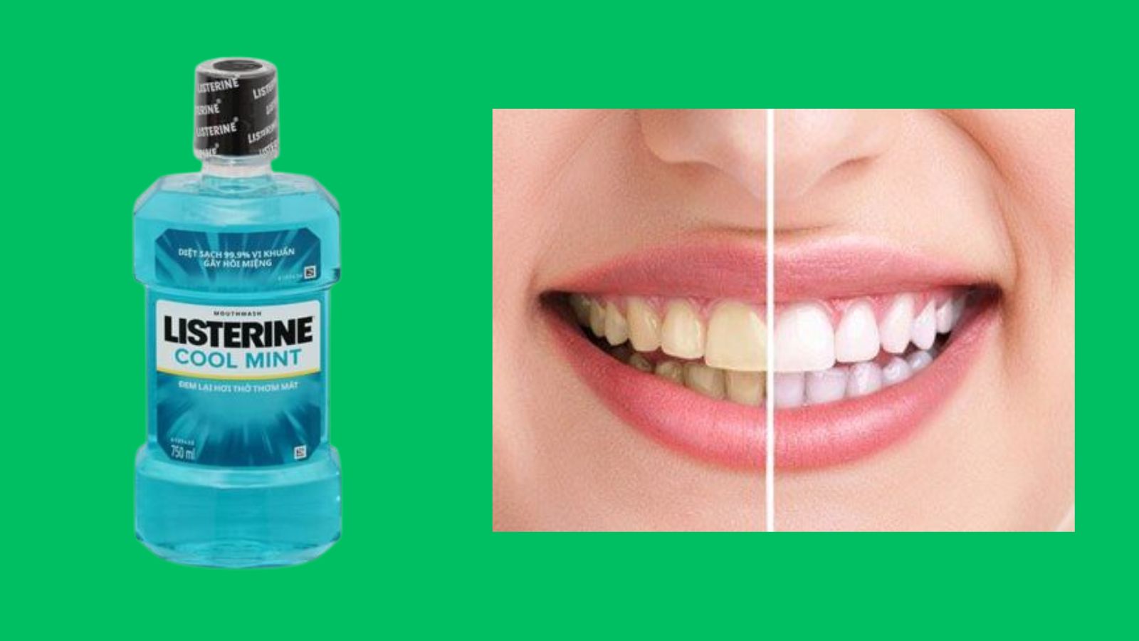 Listerine cool mint 750ml - Nước súc miệng hàng ngày
