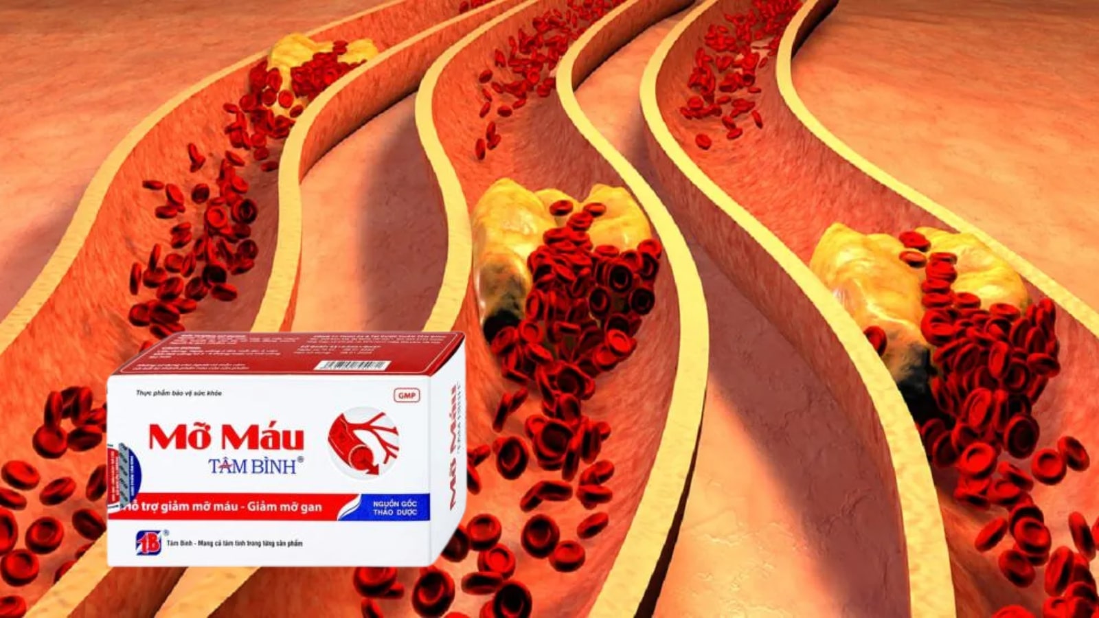 Mỡ máu Tâm Bình-Hỗ Trợ Giảm Mỡ Máu, Giảm Cholesterol