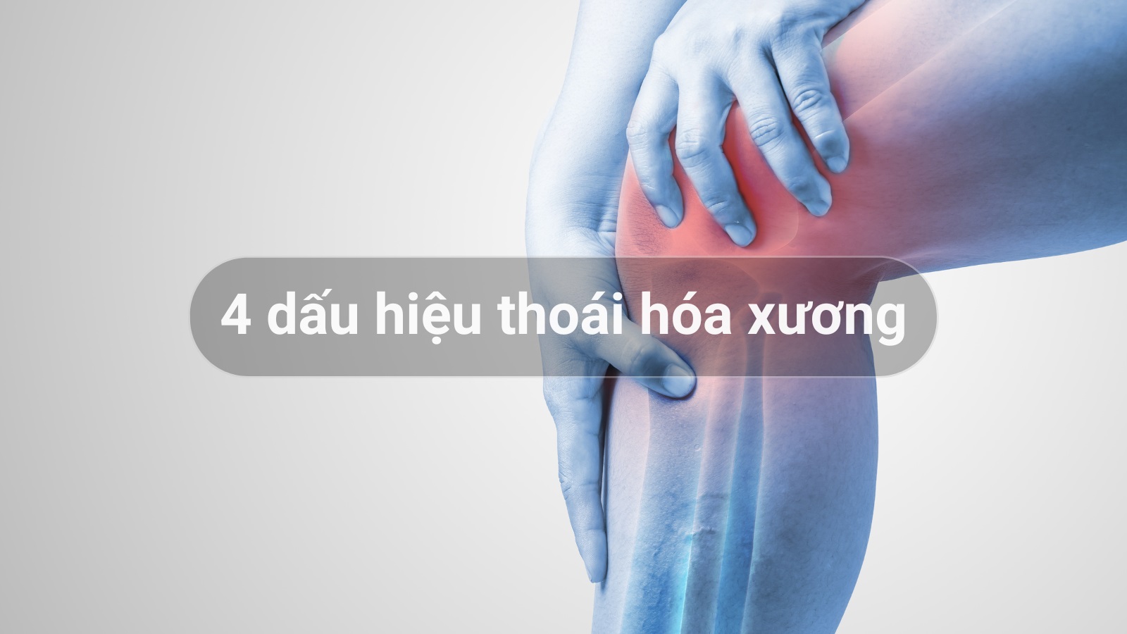 4 dấu hiệu thoái hóa sụn khớp