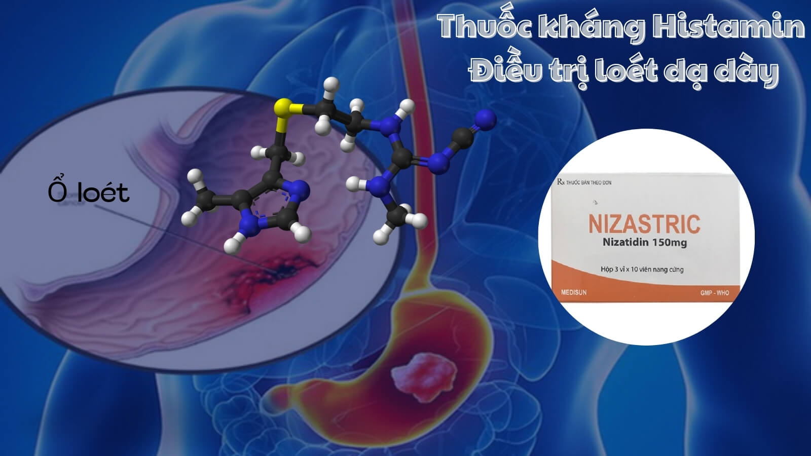 Nizastric 150 - Điều trị loét dạ dày tá tràng