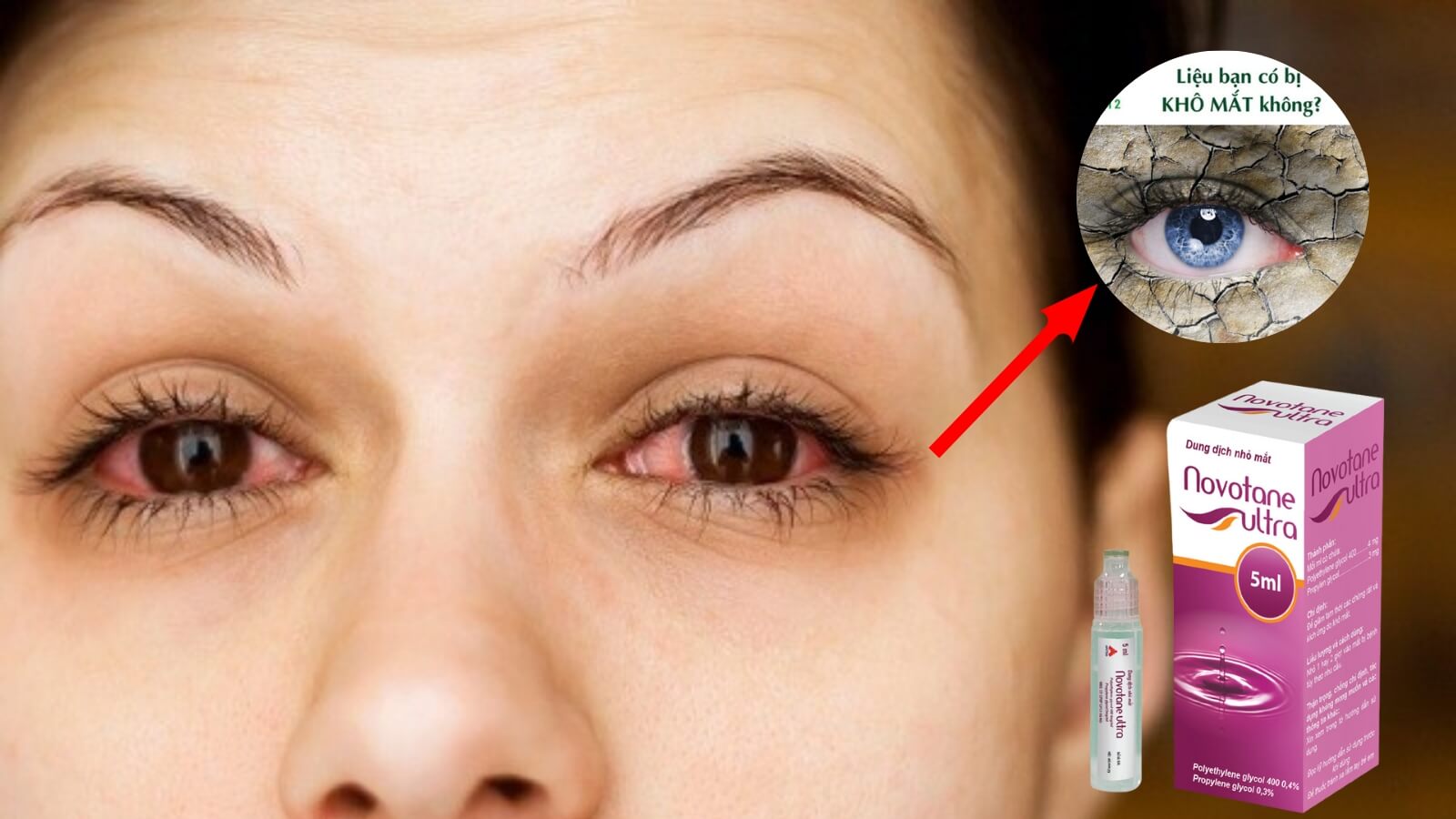 Dung dịch nhỏ mắt Novotane Ultra giúp tạo độ ẩm cho mắt.