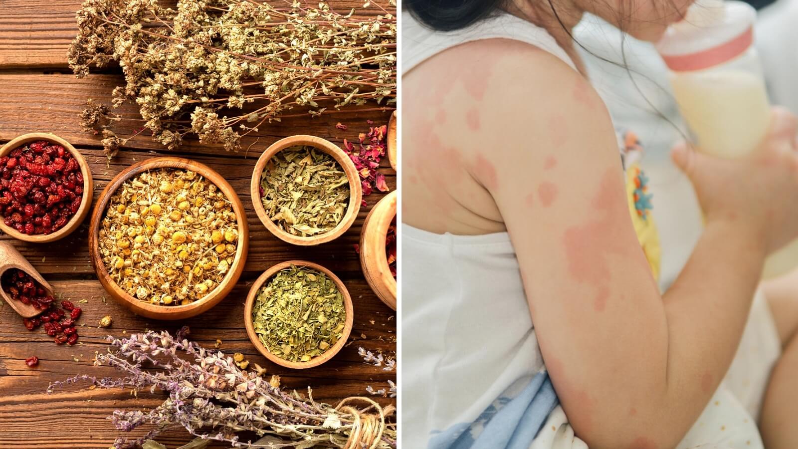 Các loại thảo dược trong Nước tắm thảo dược Dr Papie hỗ trợ điều trị ngứa ngáy, viêm da ở trẻ em