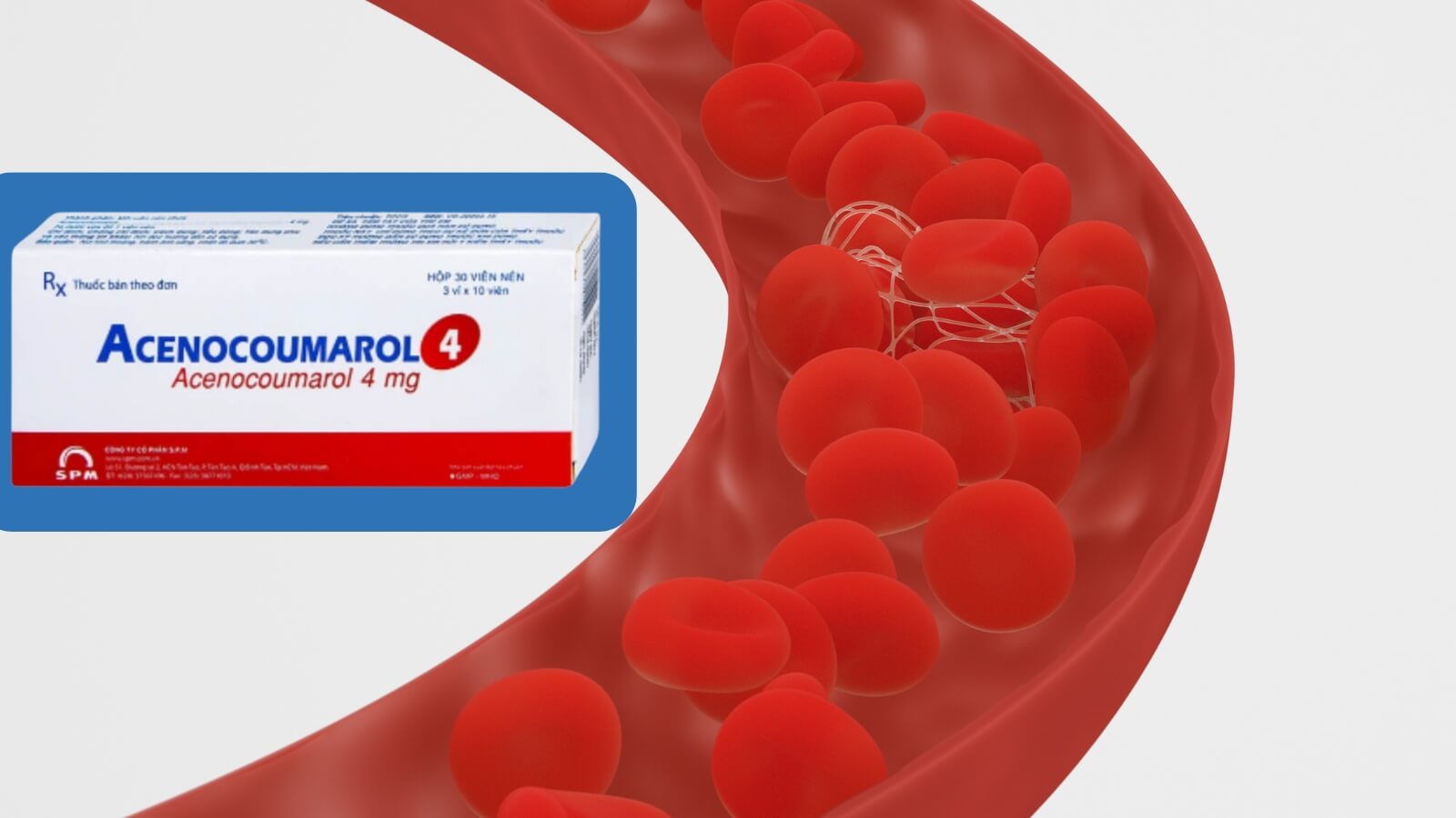 Thuốc Acenocoumarol 4mg chứa Acenocoumarol giúp chống đông máu