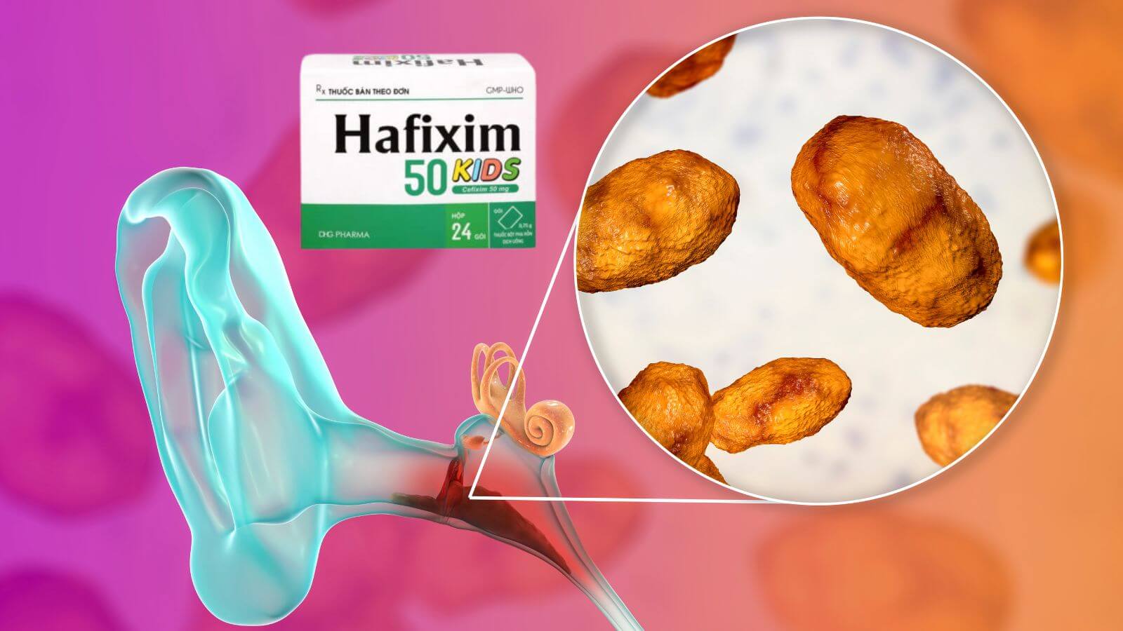 Hafixim 50 điều trị hiệu quả viêm tai giữa ở trẻ em