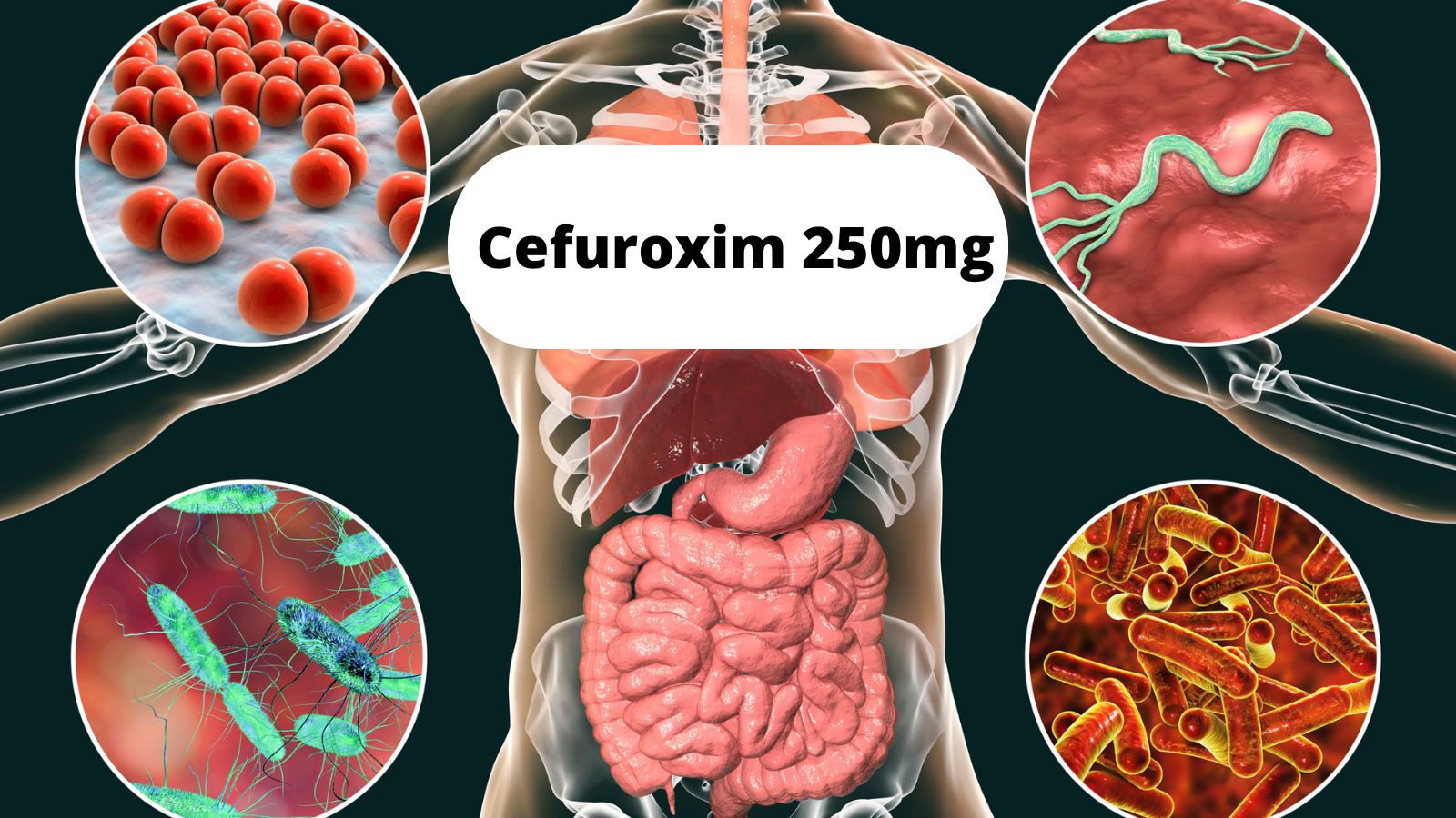 Cefuroxim thành phần chính của Zinmax 250mg