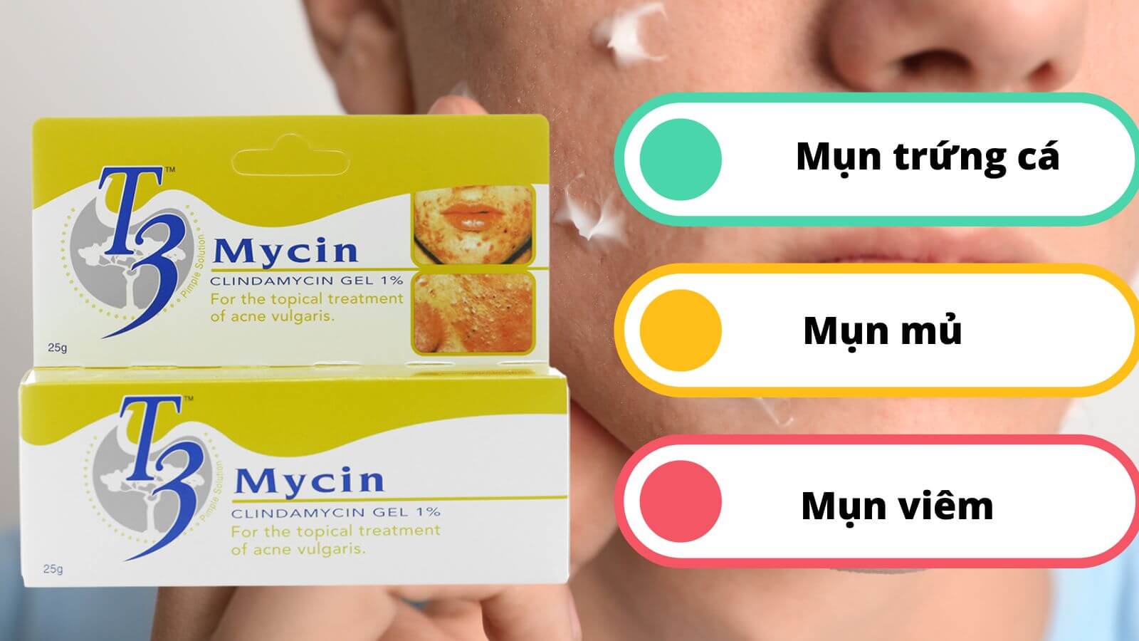 T3 mycin điều trị mụn trứng cá, mụn mủ, mụn viêm