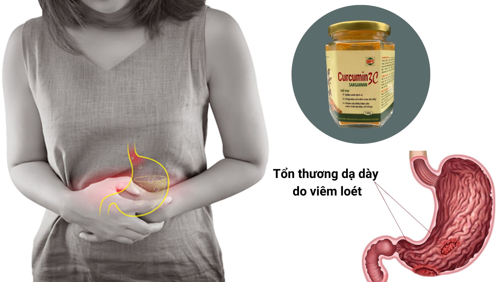 Tác dụng của tinh chất nghệ Curcumin 3C