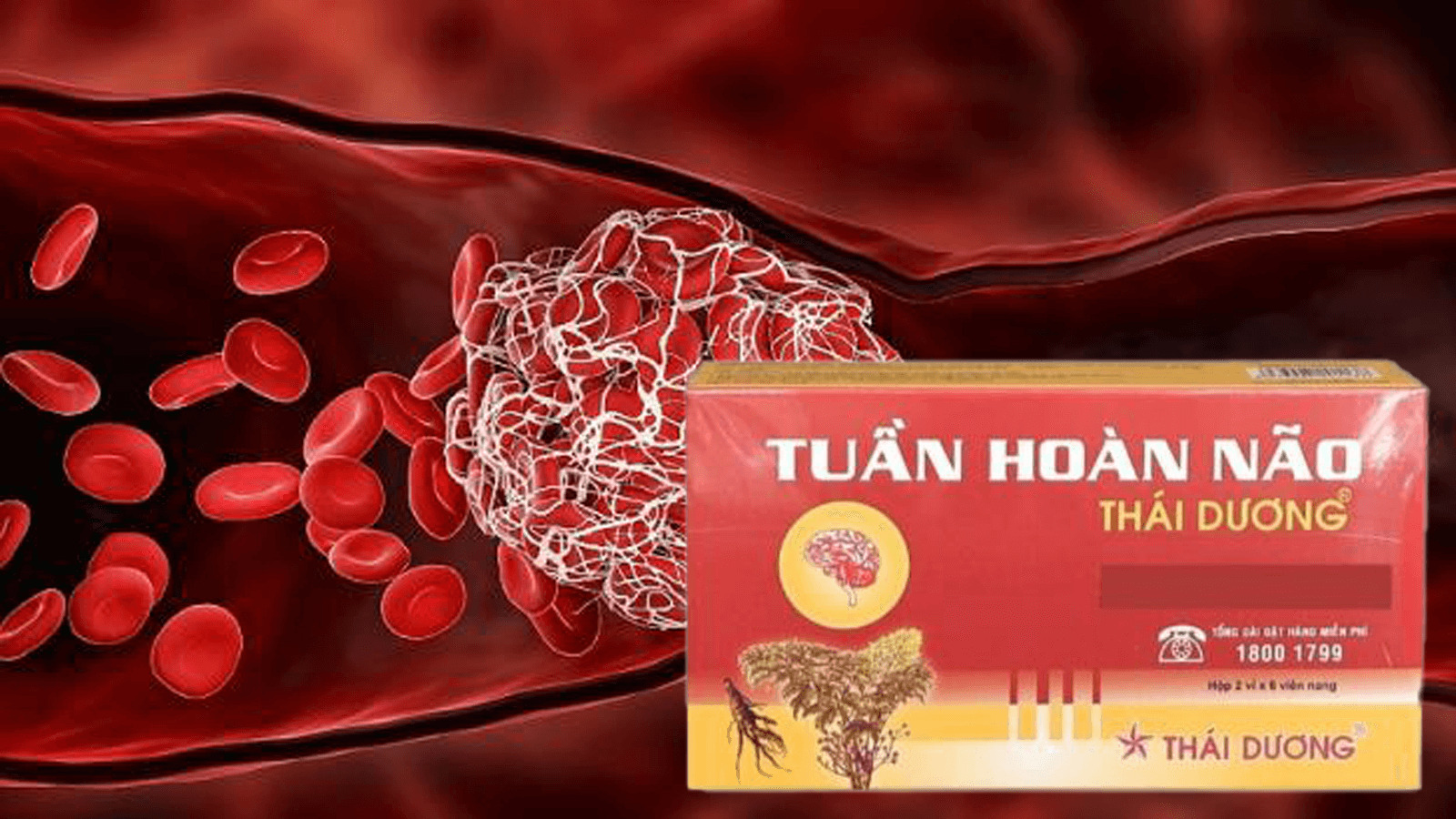 Viên tuần hoàn máu não Thái Dương