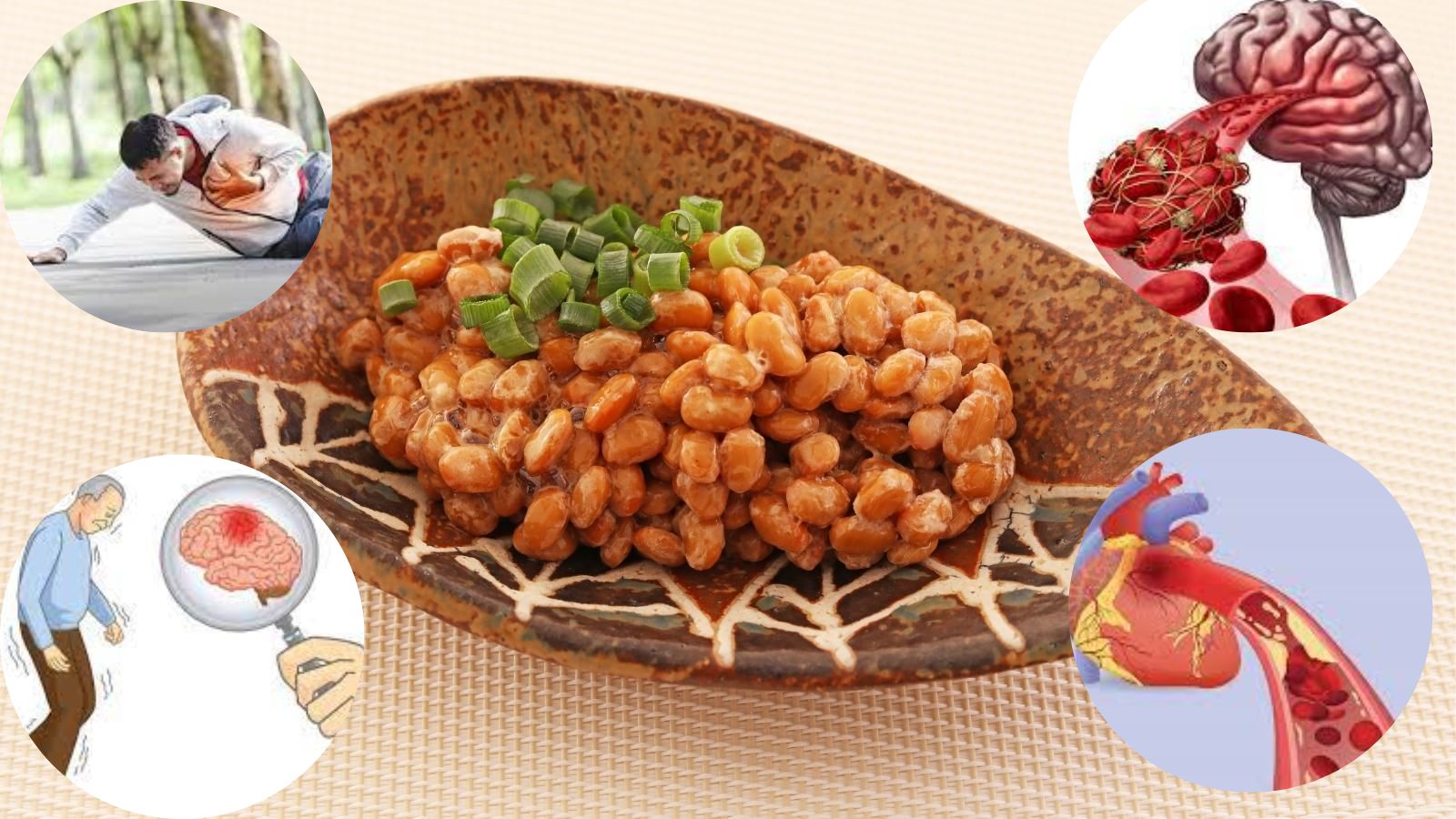 Đậu nành lên men giúp ngăn ngừa tình trạng tạo cục máu đông
