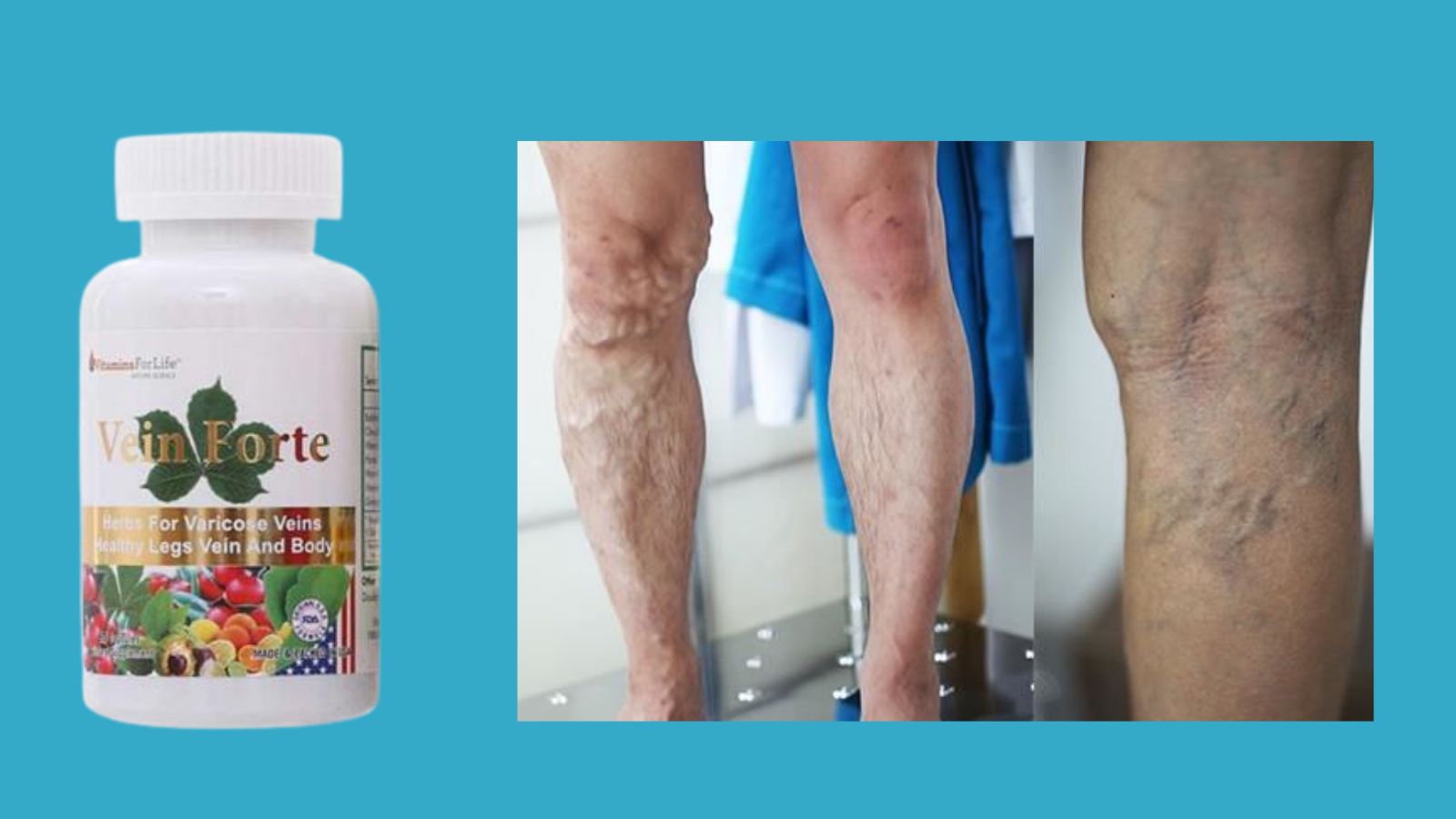 Vein Forte (60 viên) - Tăng sức bền thành mạch