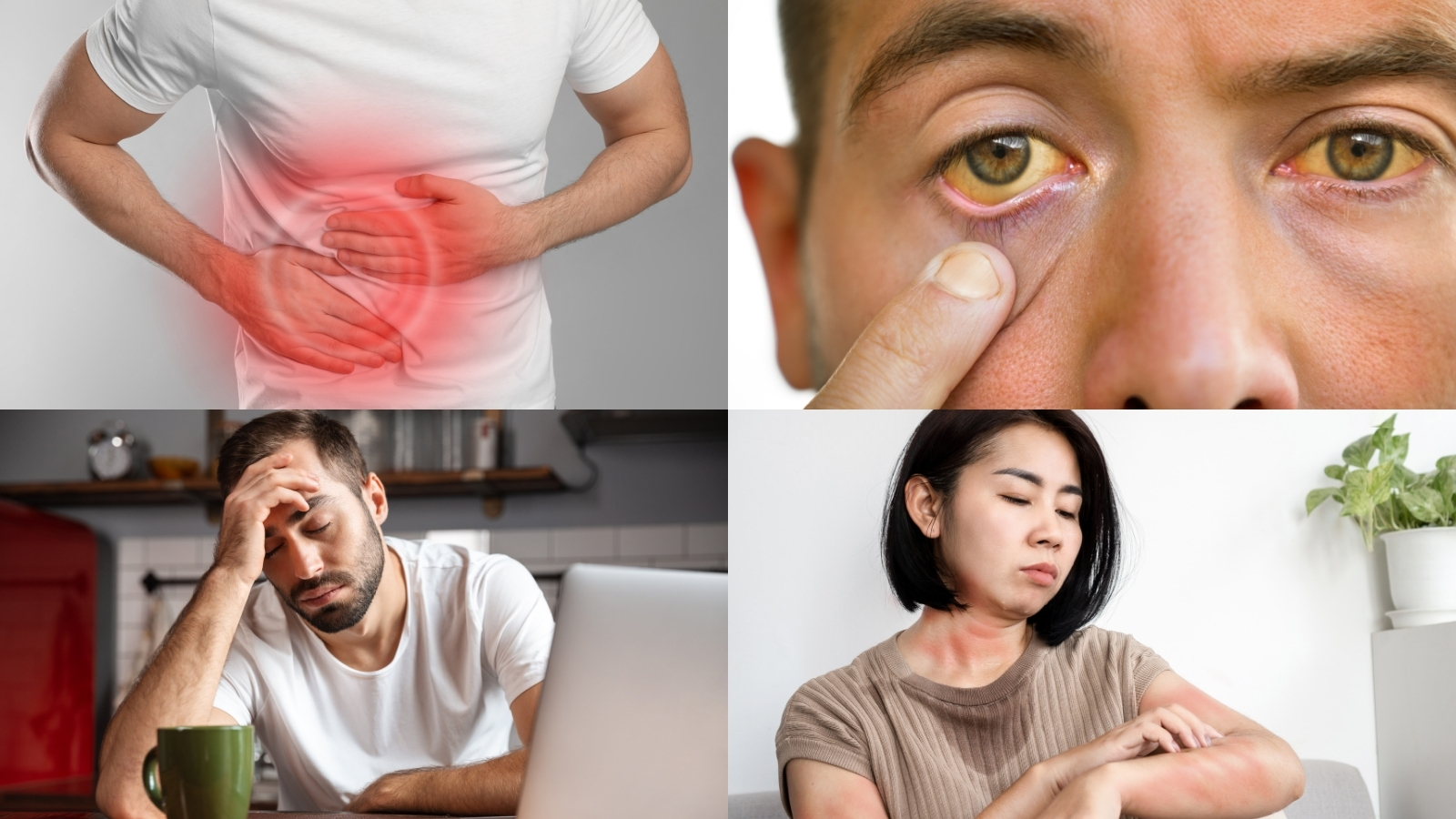 Các biểu hiện của tình trạng gan nhiễm độc