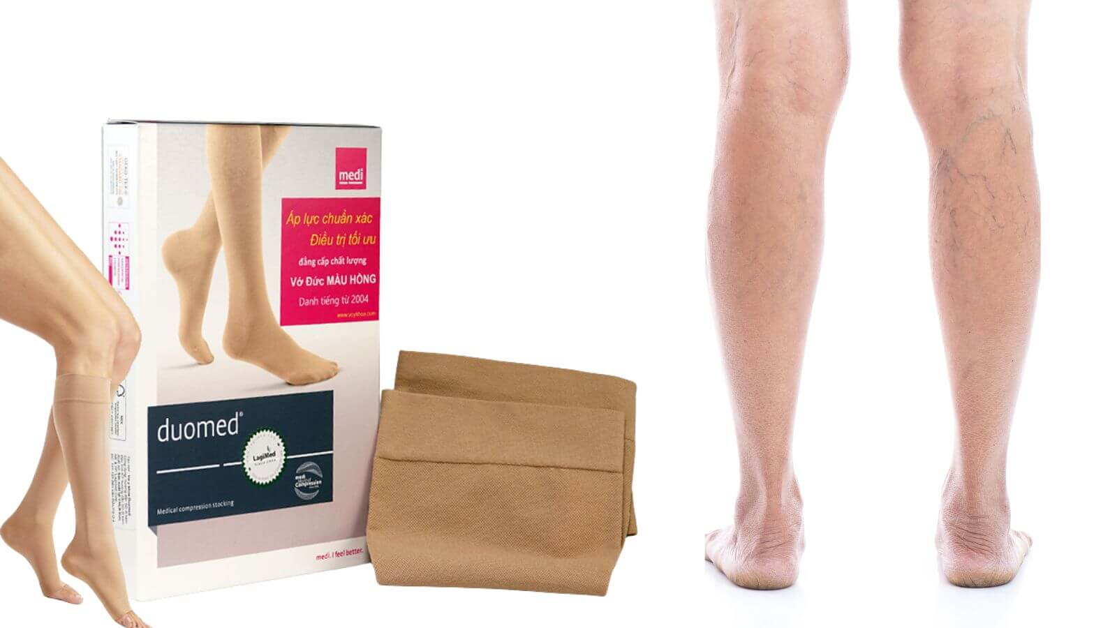 Sản phẩm hiúp cải thiện bệnh lý tĩnh mạch chi dưới